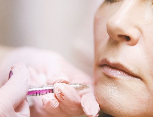 Post-Hyaluronidase Syndrome: What Happens to Your Face After Filler Dissolving