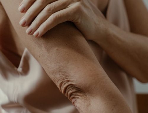 Crepey Skin: What Causes It and What Actually Helps