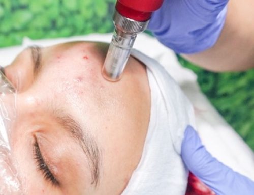 The FDA’s Warning on RF Microneedling: What Patients Should Know